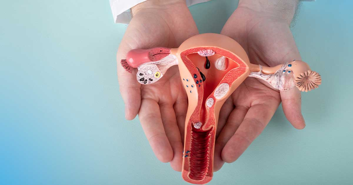 Endometriose